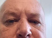 Photo de arginuses