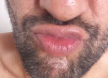 Photo de hanniboule