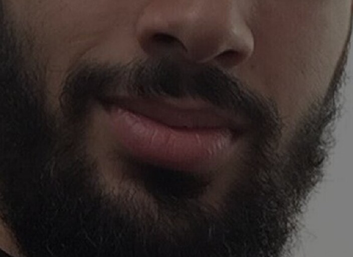 xxxx17