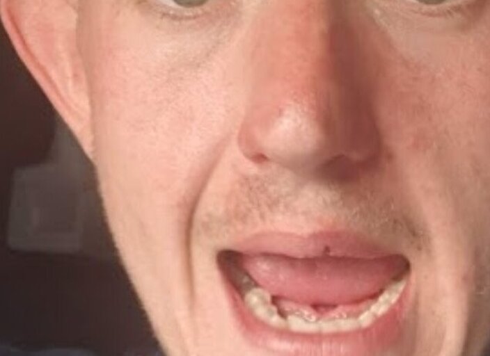 chgaib