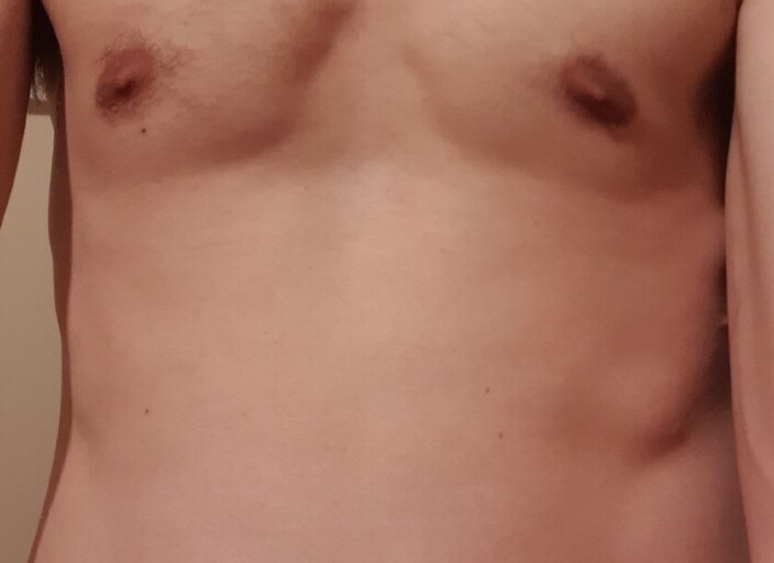 tititito