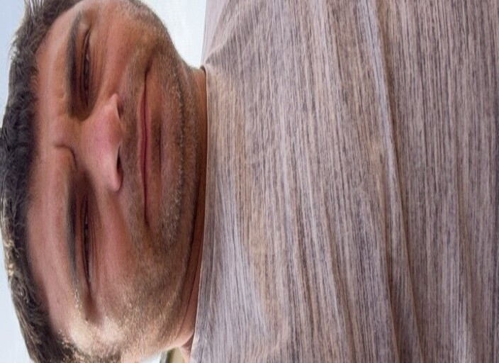 MA2x