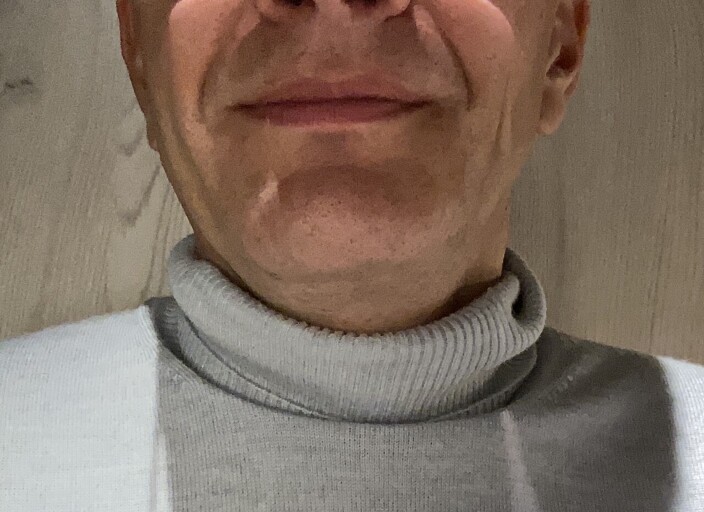 Chris78