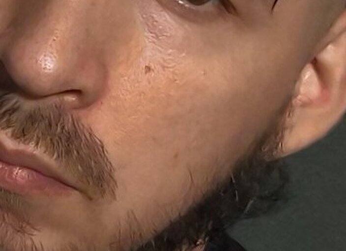 Inconnitoo