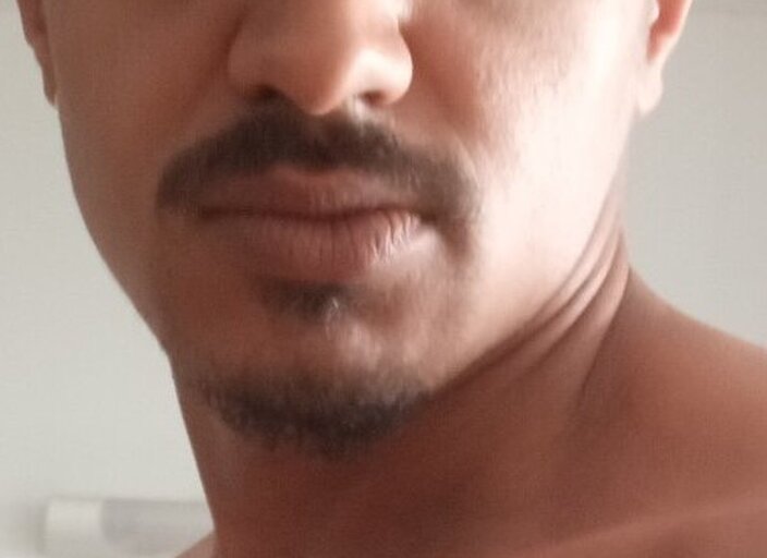 malc