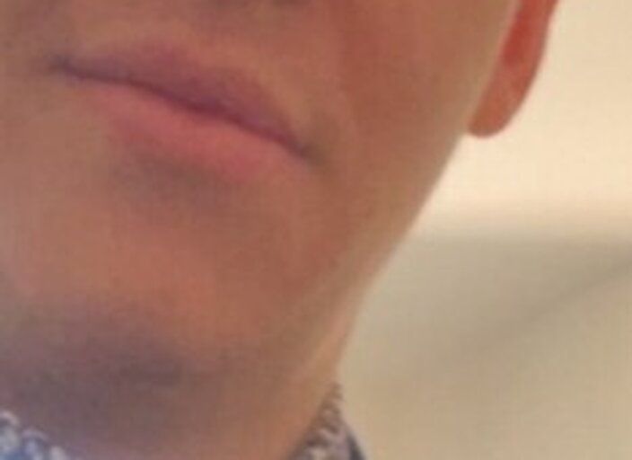 tarpe