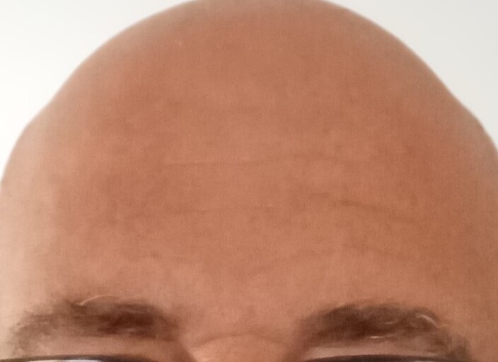 lechauveauyeuxbleu