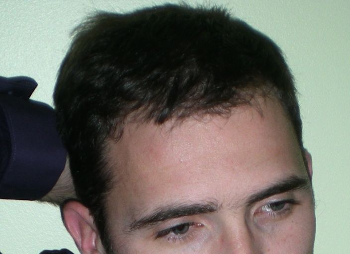 viach17