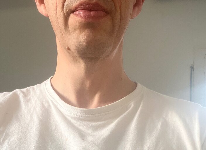 Bdgp