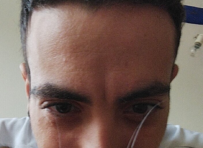 Skipou