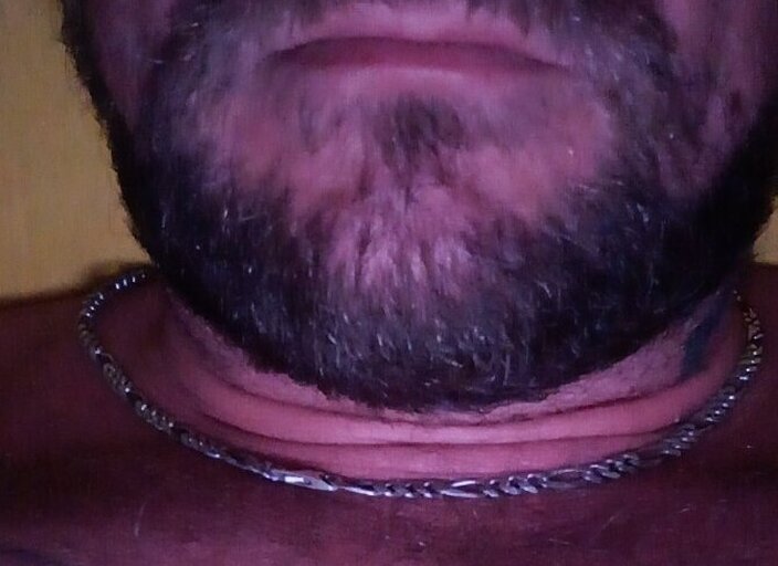 payo76