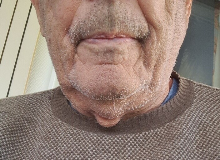 ytneg